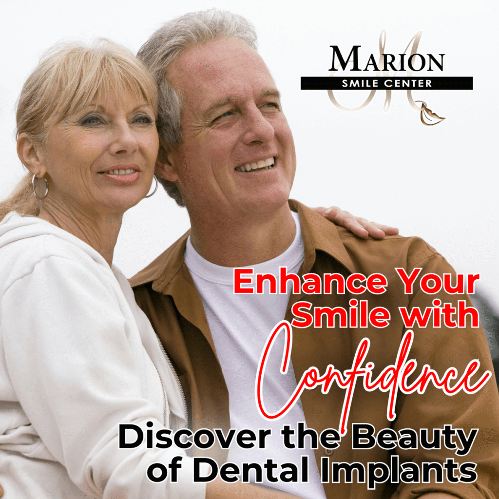 dental implants