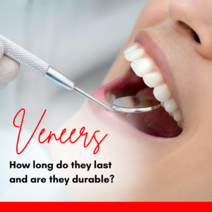 veneers durability