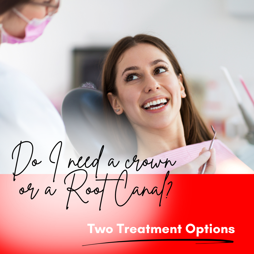 Crown or Root Canal