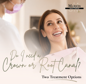 Crown vs Root Canal