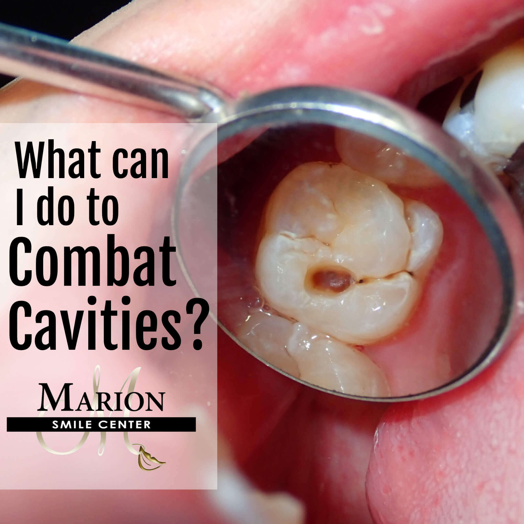 cavities-at-once-edu-svet-gob-gt