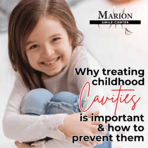 Childhood Cavities - Pediatric Dentistry in Zelienople PA