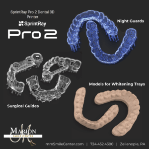 Image of 3D implant surgical guides, teeth whitening models, and night guards.