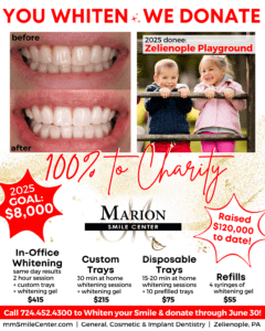 Teeth Whitening For Charity