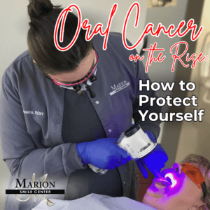 Image of client getting oral cancer screening to protect himself. 